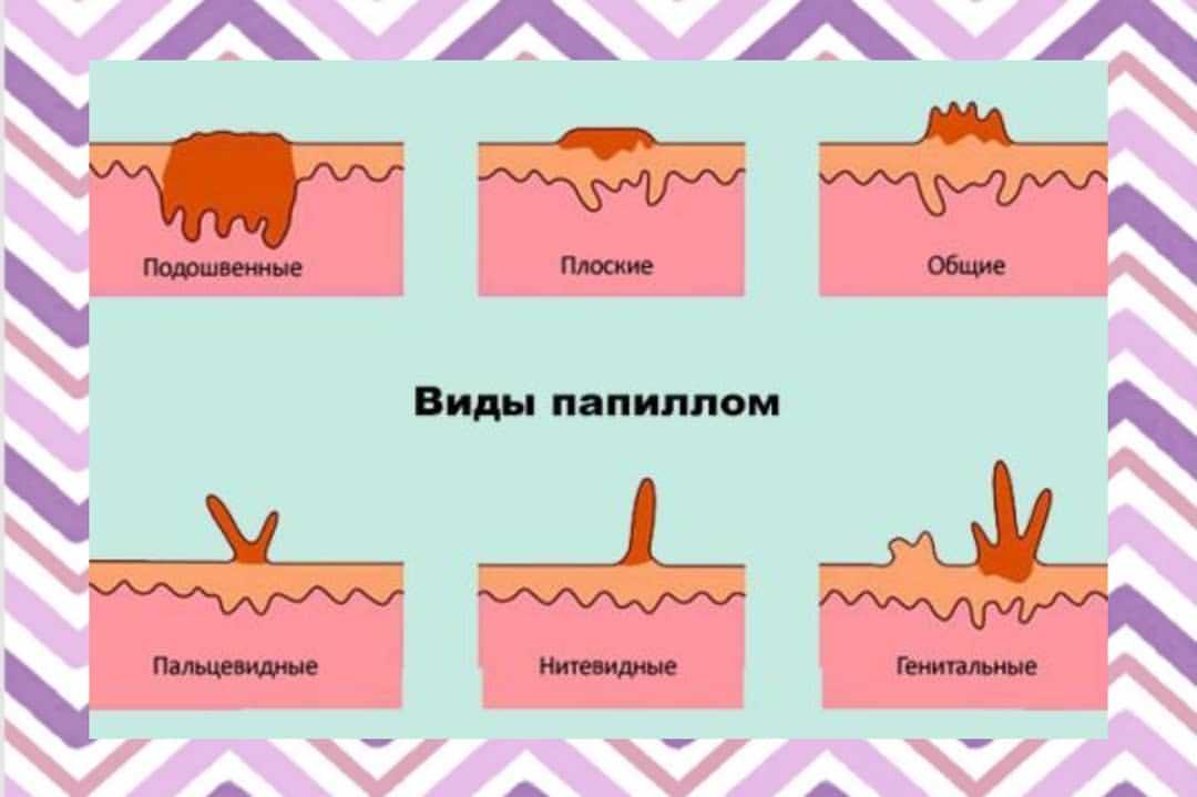 Потеет лобовое стекло: 5 методов борьбы с причинами